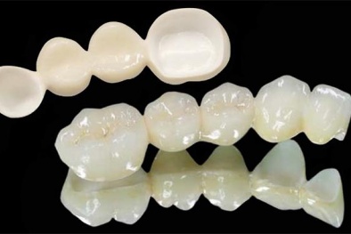 Trung Quốc: Răng giả rẻ tiền chứa độc nguy hiểm