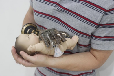 Công nghệ da nhân tạo mới đột phá trong lĩnh vực y học