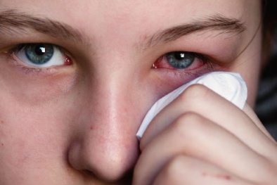 Khăn mặt kém chất lượng gây viêm da và mắt