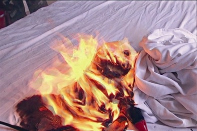 Bé trai bỏng nặng 'vùng kín' vì dùng máy sấy tóc sai cách