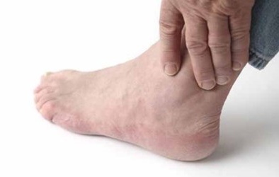 Những điều kiêng kỵ khi ăn ngày Tết của người bệnh gút 