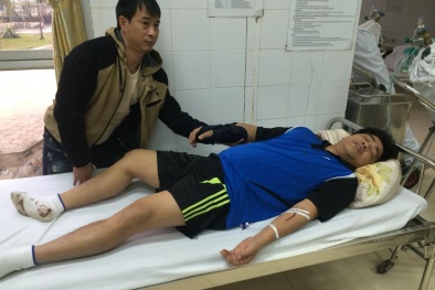 Quận Nam Từ Liêm: Côn đồ 'xử' chủ nhà ngay tại phòng khách 