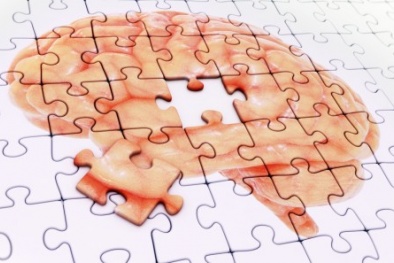 Lý giải các triệu chứng bệnh Alzheimer trên chuột thí nghiệm 