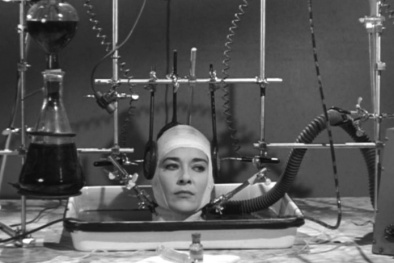 Đón chờ thành công công nghệ cấy ghép đầu người vào năm 2017