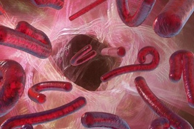 Phát hiện tác hại khôn lường từ những di chứng để lại của bệnh Ebola