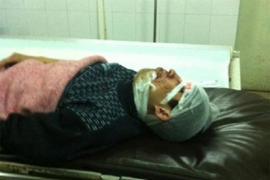 Trước cười đùa, sau chém nhau vì xích mích chỗ để xe