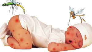 Cách trị muỗi đốt cho trẻ nhỏ vào mùa mưa 