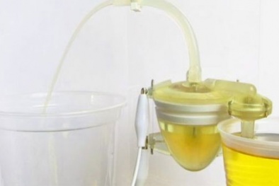 Công dụng của nước tiểu tạo ra những phát minh ấn tượng