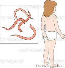 Hoảng hốt vì bé gái nhỏ tuổi viêm âm đạo do giun kim