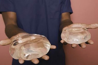 Nâng ngực dễ bị ung thư?
