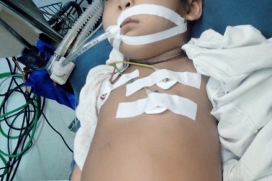 Cắt bỏ khối u cho bệnh nhi người Lào