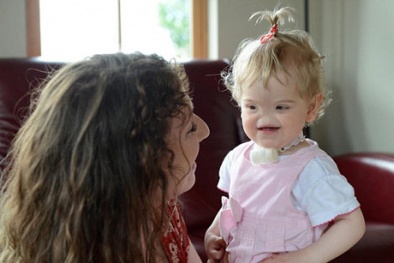 Sức sống mạnh mẽ của em bé không mũi