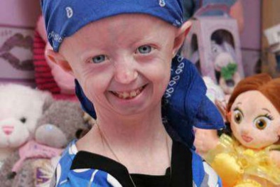 'Thiếu niên 100 tuổi' qua đời ở tuổi 17