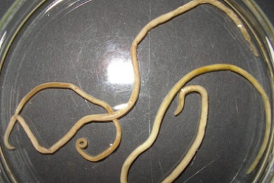 Tại sao uống thuốc tẩy đều đặn mà vẫn nhiều giun?