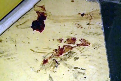 Em bé lỡ tay 'giết' mẹ ở tuổi lên 2 