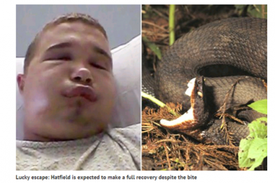 Nhập viện cấp cứu vì cố hôn rắn hổ mang để chụp ảnh