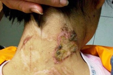 Ăn cả bọc nhựa quần áo vì bị bỏ đói trong 2 năm trời làm nô lệ