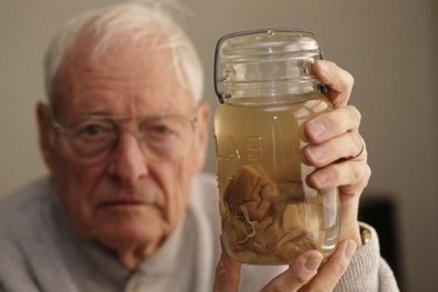 Hé lộ thông tin bí ẩn về bộ não bị đánh cắp của Einstein 