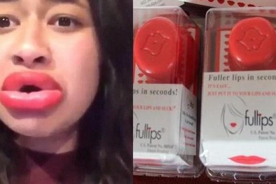 Gặp họa vì dụng cụ bơm môi cấp tốc