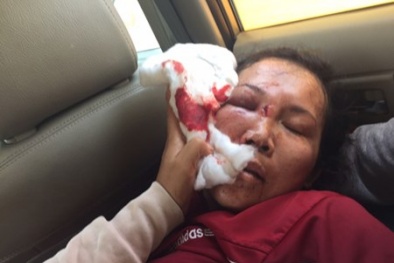 Phẫn nộ cả nhà công an xã đánh một phụ nữ ngất xỉu để xiết nợ