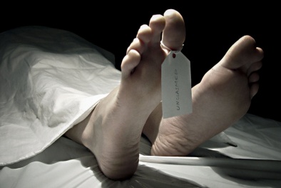 Bí mật về sự biến đổi của cơ thể con người sau khi chết 