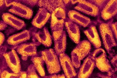 Mỹ: Phát hiện chủng virus mới gây bệnh dại từ loài dơi