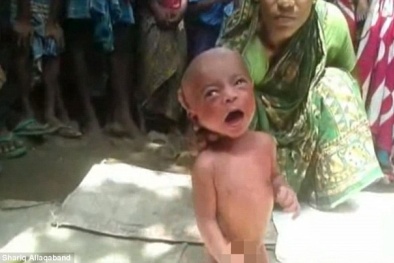 Hậu quả việc phơi nắng trẻ sơ sinh để trị cảm sốt