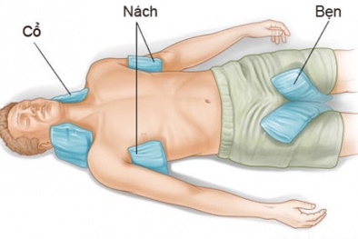 Cách sơ cứu và phòng tránh say nắng