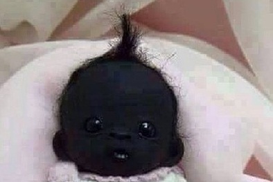 Hiện tượng lạ: Em bé Nam Phi đen nhất thế giới