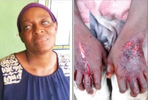 Xát ớt, rạch tay cháu ruột vì dám đi xin ăn 