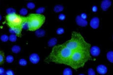  Đọc báo hôm nay: Những tin tức mới cập nhật 24h ngày 30/6/2015