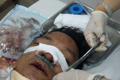 Nhóm giang hồ xăm trổ xông vào quán ăn chém không thương tiếc một thực khách