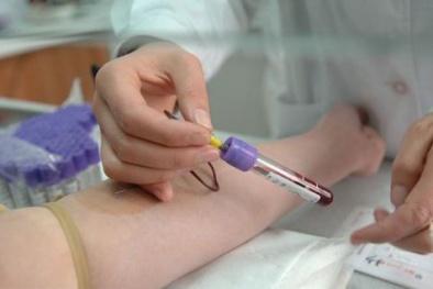  Đoán nguy cơ mắc chứng mất trí qua xét nghiệm máu