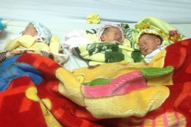 Ca sinh 3 khác trứng hiếm gặp