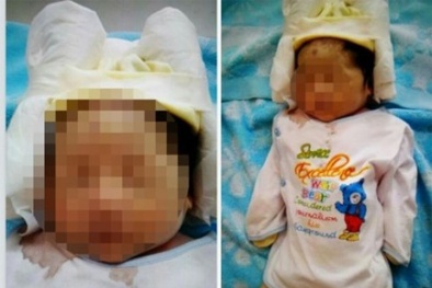 Trẻ sơ sinh bị “trào ruột khỏi bụng’ chết bất thường: Bộ Y tế yêu cầu Cần Thơ giải trình