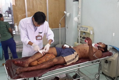 Đắk Nông: Cắt cỏ trúng đầu đạn M79, 4 người bị thương