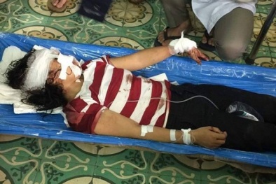 Bắc Giang: Căm phẫn người chồng bạo hành vợ dã man