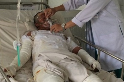 Tưới xăng tự thiêu vì ghen tuông: Chồng chết, vợ mang thai nguy kịch