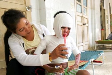 Mẹ dập lửa xăng không đúng cách, con thành đuốc sống giữa nhà