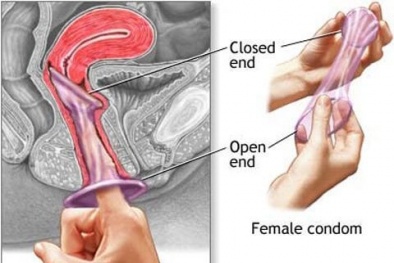 Những ưu điểm tuyệt vời của bao cao su nữ