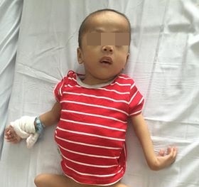 Bé trai 5 tuổi bị chó cắn đứt dương vật
