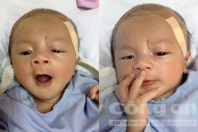 Ngày về mạnh khỏe bình an của bé trai bị dao đâm vào đầu