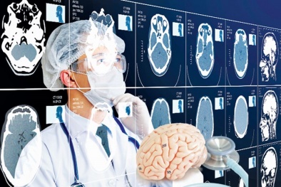 Đột phá trong nghiên cứu não người