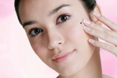 Nhìn nốt ruồi chẩn đoán ung thư 