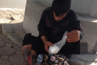 Sự thật về chiếc chân hoại tử lòi thịt của thanh niên ăn xin trên phố