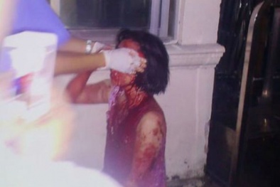 Nạn nhân vụ đánh mìn ở Hà Nội lết đi được một đoạn rồi gục ngã