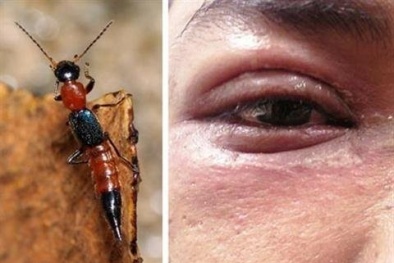 Kiến 3 khoang vào mùa, chuyên gia mách cách ‘trị’