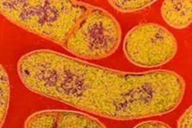 Tìm hiểu vi khuẩn hình que trong thịt vịt khiến cả gia đình ngộ độc