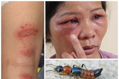 Không khó để phòng trừ kiến ba khoang