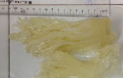 Coi chừng ‘tiền mất, tật mang’ vì vi cá mập từ nhựa dẻo